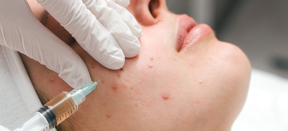 Acne Treatments / AC Dual