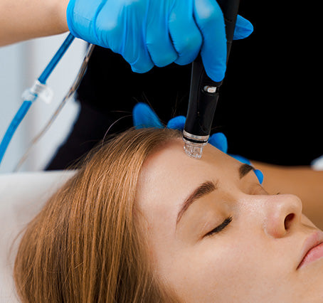 Nano Fractional Resurfacing