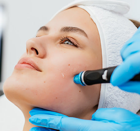 RF Microneedling — Face / Package of 3