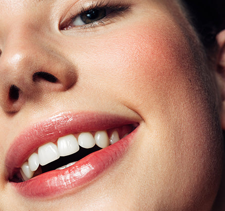 Teeth Whitening